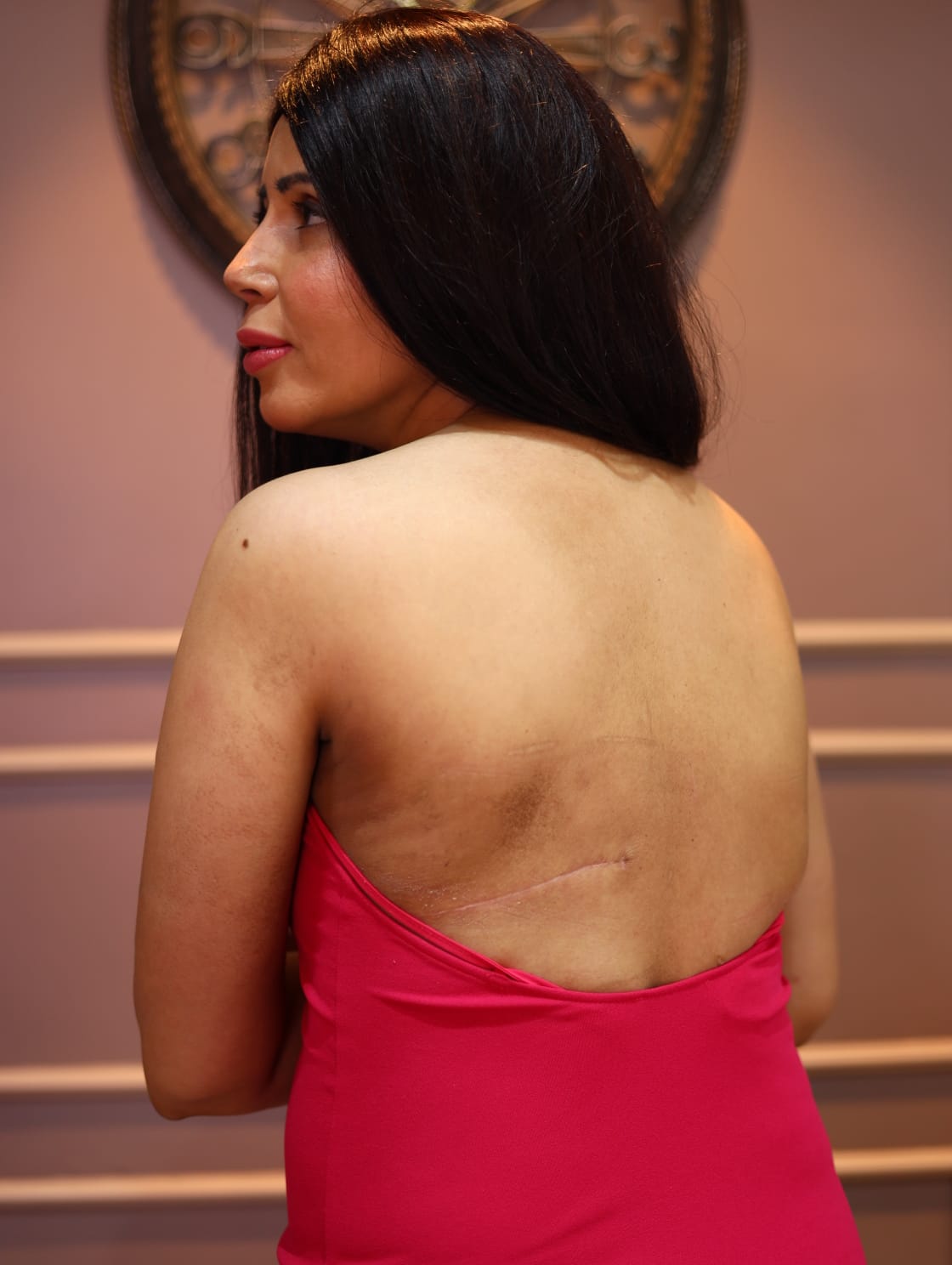 Rozlyn Khan: A Brave Journey Inspired by Selena Gomez